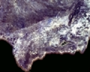 overview